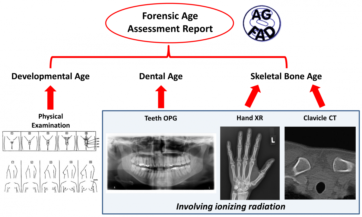 Forensic Age Estimation
